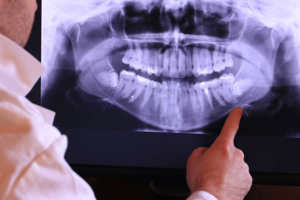 Best Weekend Emergency Dentist in Chestertown, MD